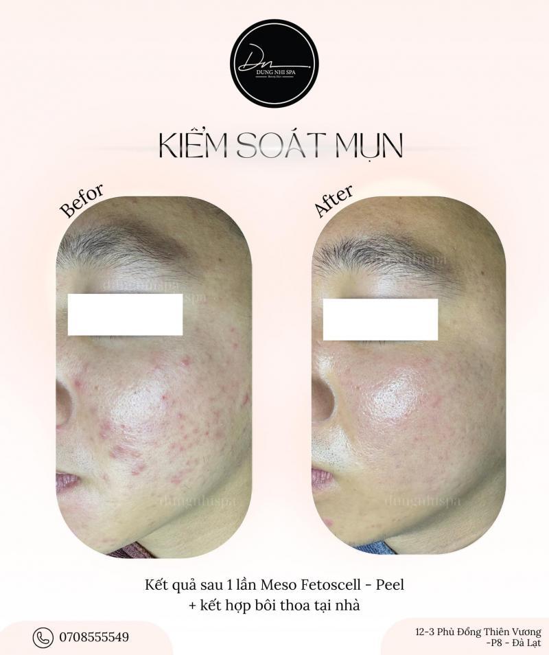 Top 9 Spa làm đẹp uy tín và chất lượng tại Đà Lạt