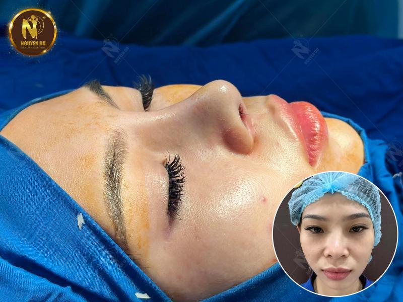 7 địa chỉ phun môi uy tín nhất Long Xuyên, An Giang – Trải nghiệm đẳng cấp