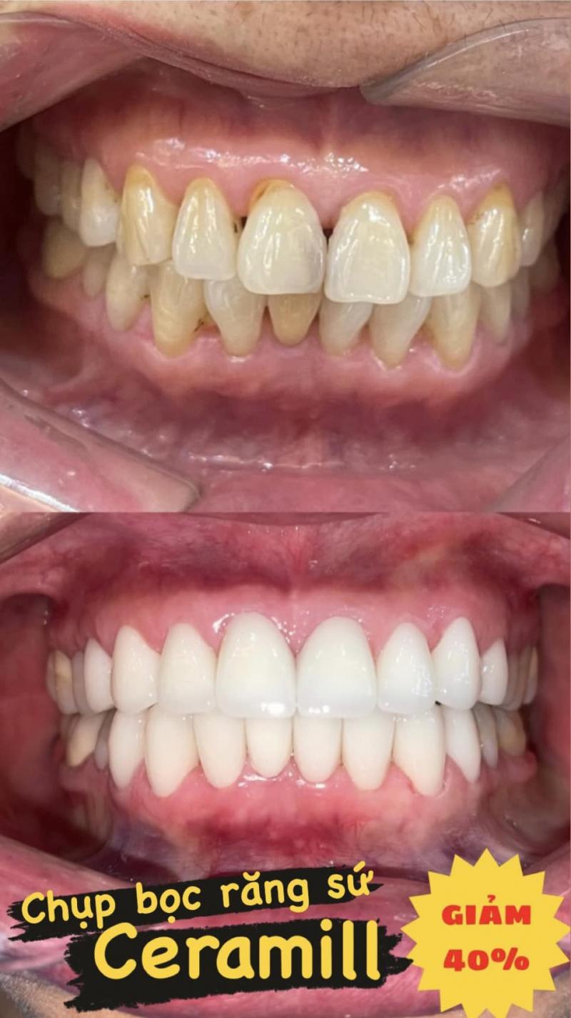 7 Địa chỉ nha khoa chất lượng hàng đầu tại Đông Anh, Hà Nội
