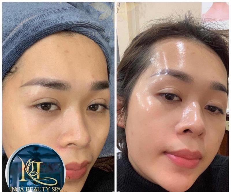 7 Spa chăm sóc da mặt chất lượng nhất quận Long Biên, Hà Nội