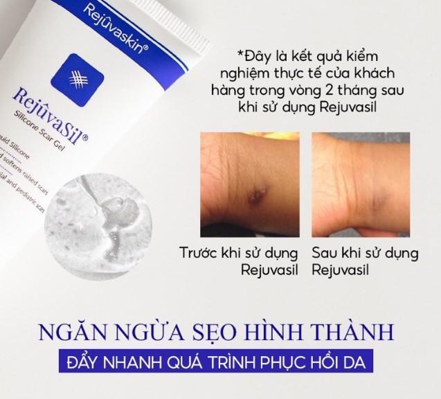 Top 8 loại kem trị sẹo thâm an toàn và hiệu quả dành cho bé yêu