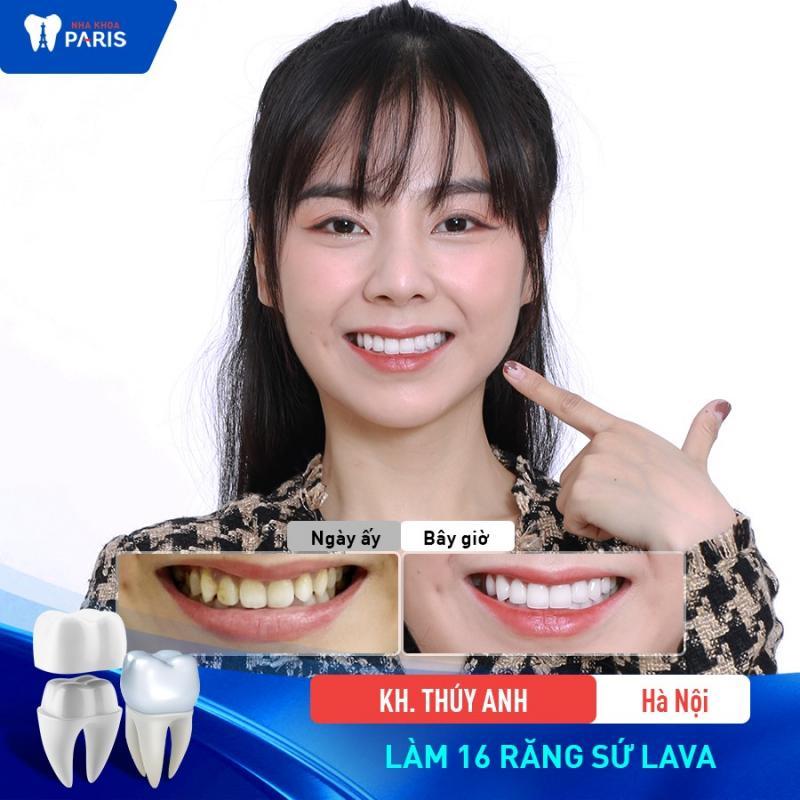 7 địa chỉ bọc răng sứ thẩm mỹ chất lượng nhất tại quận Đống Đa, Hà Nội