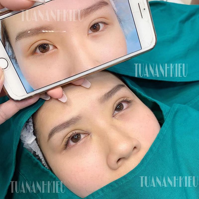 Top 10 địa chỉ mở góc mắt đẹp chuẩn y khoa và uy tín nhất tại TP.HCM
