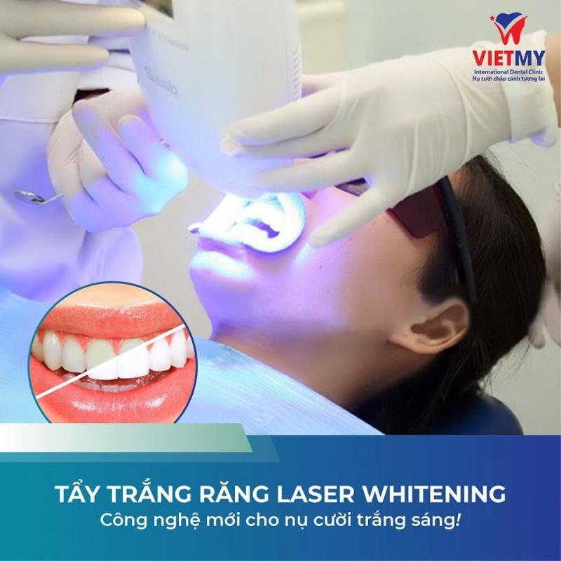 Top 5 địa chỉ nha khoa tẩy trắng răng chất lượng nhất quận Thanh Xuân, Hà Nội