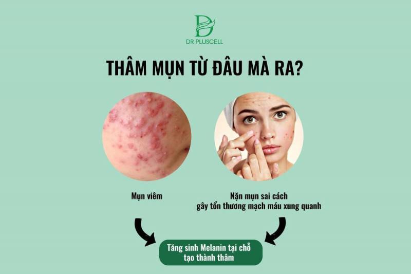 Top 9 địa chỉ spa trị mụn chất lượng nhất Quận 7, TP.HCM - Đánh giá chi tiết