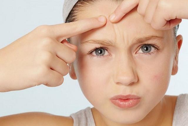 Top 10 Bí quyết chăm sóc da mụn