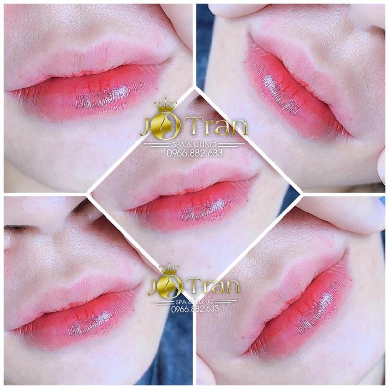 Top 8 Địa chỉ tiêm filler – botox đáng tin cậy và chất lượng nhất tại Thái Nguyên