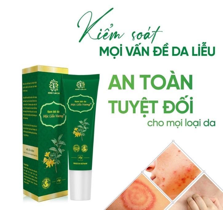 12 loại kem trị viêm da, dị ứng và ngứa da hiệu quả nhất hiện nay