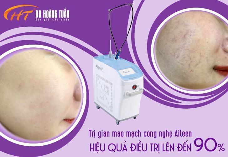 Top 9 địa chỉ trị giãn mao mạch hiệu quả và uy tín nhất tại Hà Nội