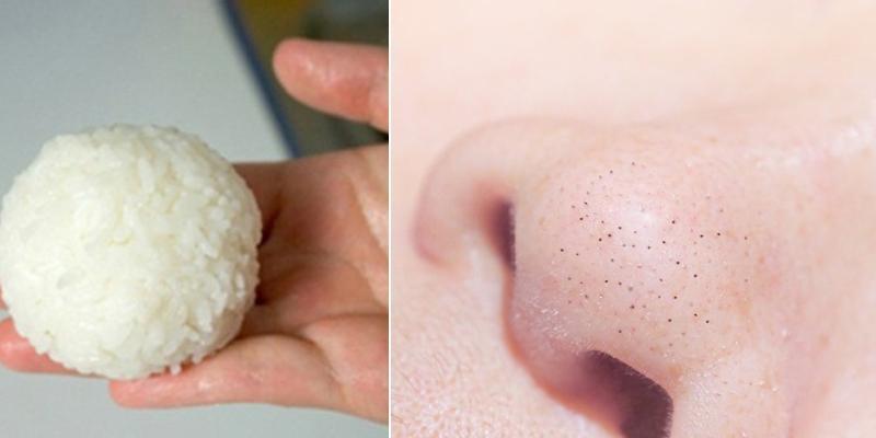 12 Cách đánh bay mụn đầu đen tại nhà hiệu quả bất ngờ - Bí quyết cho làn da sạch mịn