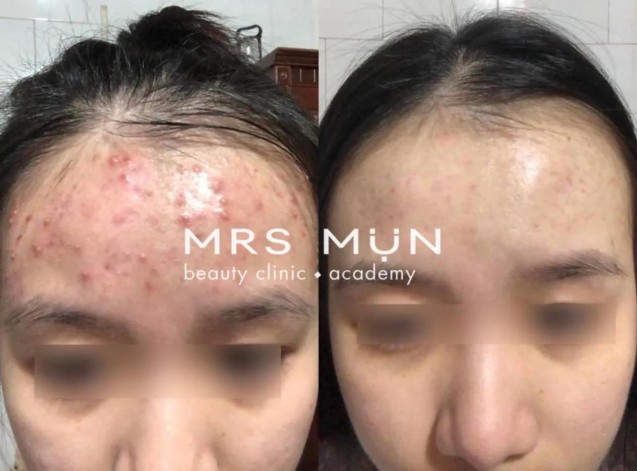 7 Spa làm đẹp đáng trải nghiệm nhất tại thành phố Kon Tum