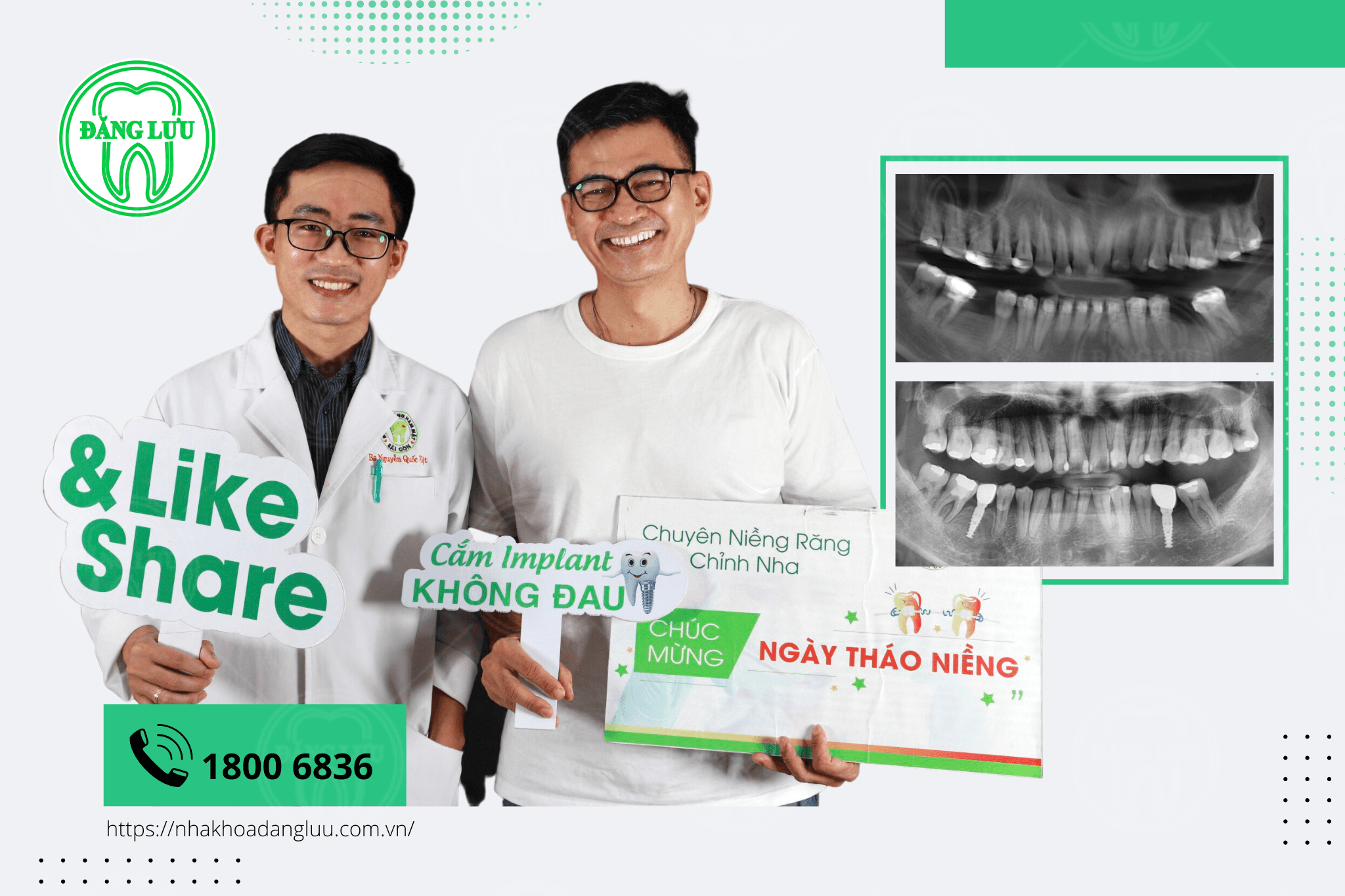 5 địa chỉ trồng răng implant đáng tin cậy nhất tại quận Bình Thạnh, TP.HCM