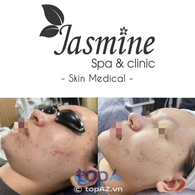 5 địa chỉ spa trị mụn tại Hải Phòng đáng trải nghiệm: Hiệu quả chuẩn y khoa, an toàn vượt trội