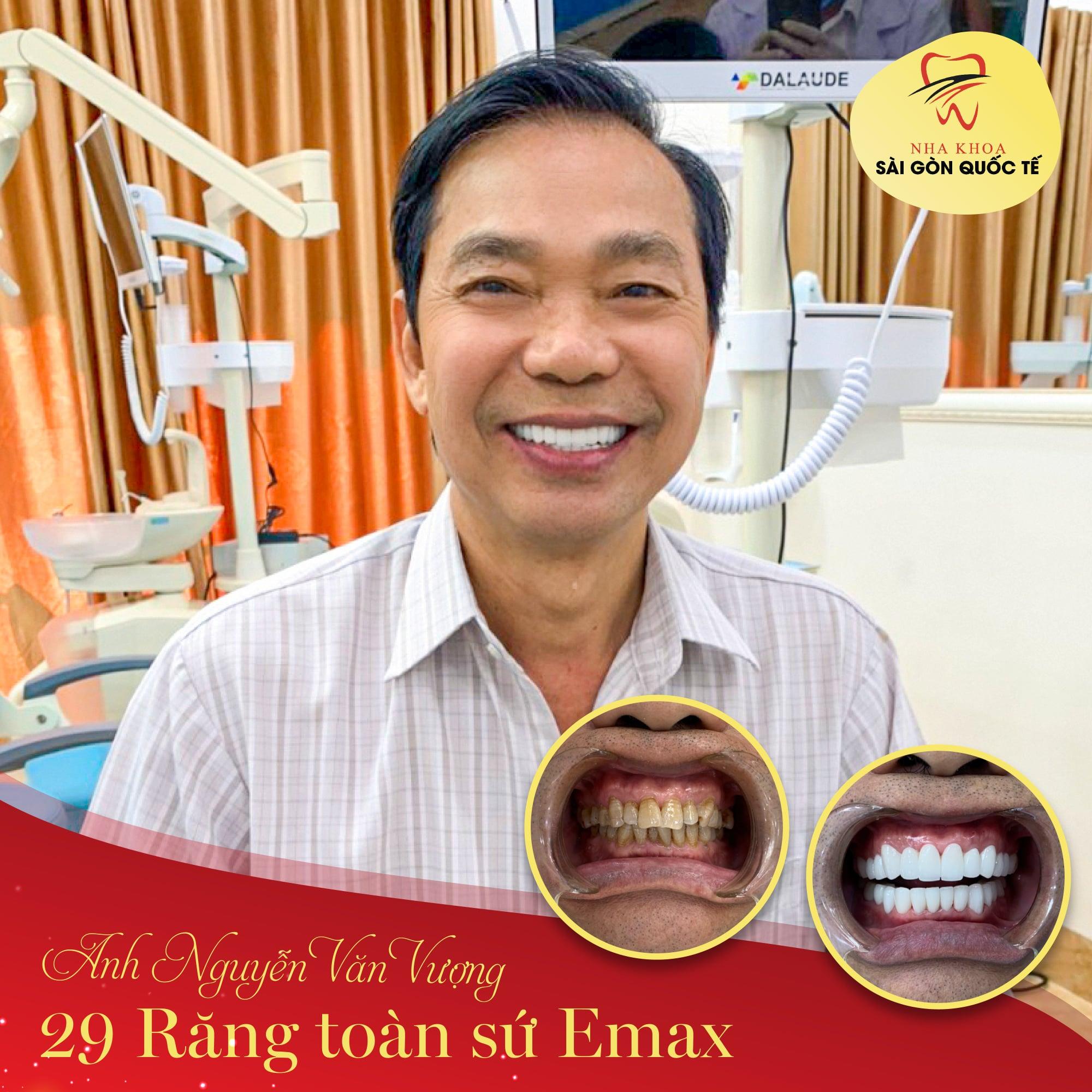Top 5 địa chỉ phòng khám nha khoa đáng tin cậy nhất tại Phú Quốc