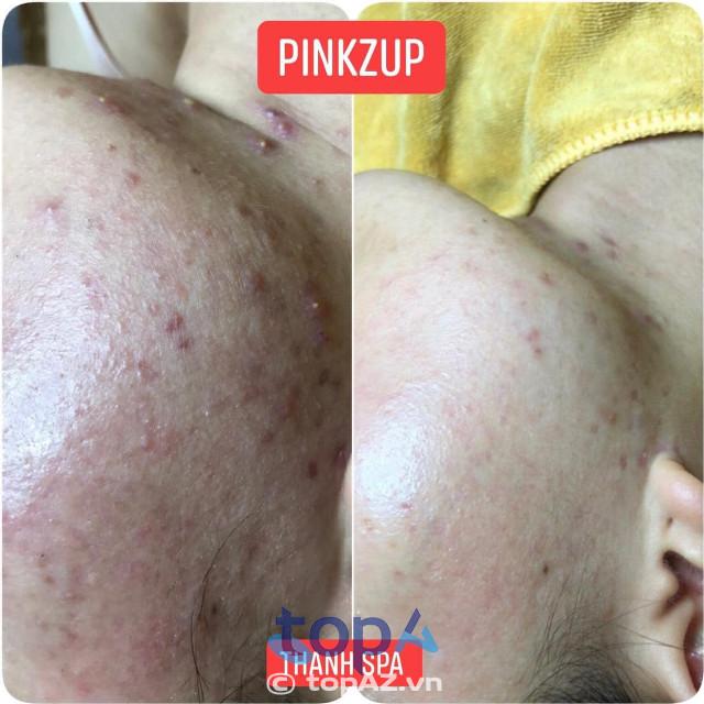 7 Địa Chỉ Trị Mụn Uy Tín Nhất Huyện Châu Đức, Bà Rịa – Vũng Tàu