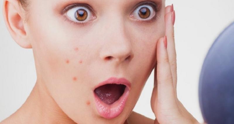 13 Dấu hiệu cho thấy bạn đang tiêu thụ quá nhiều đường