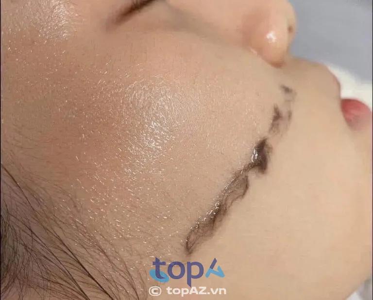 Top 5 Spa triệt lông đáng tin cậy tại H. Củ Chi được yêu thích