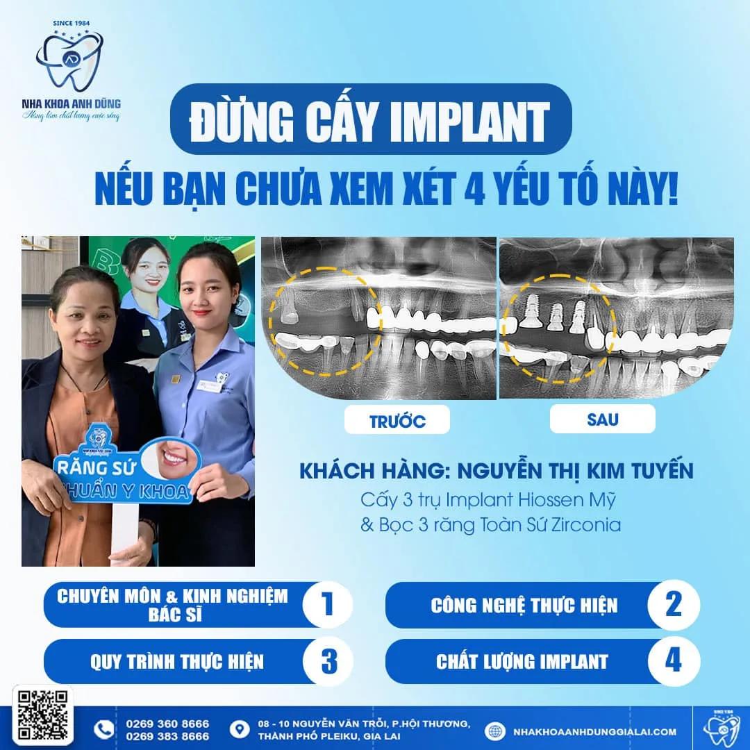 Top 9 địa chỉ nha khoa đáng tin cậy nhất tại thành phố Pleiku, Gia Lai