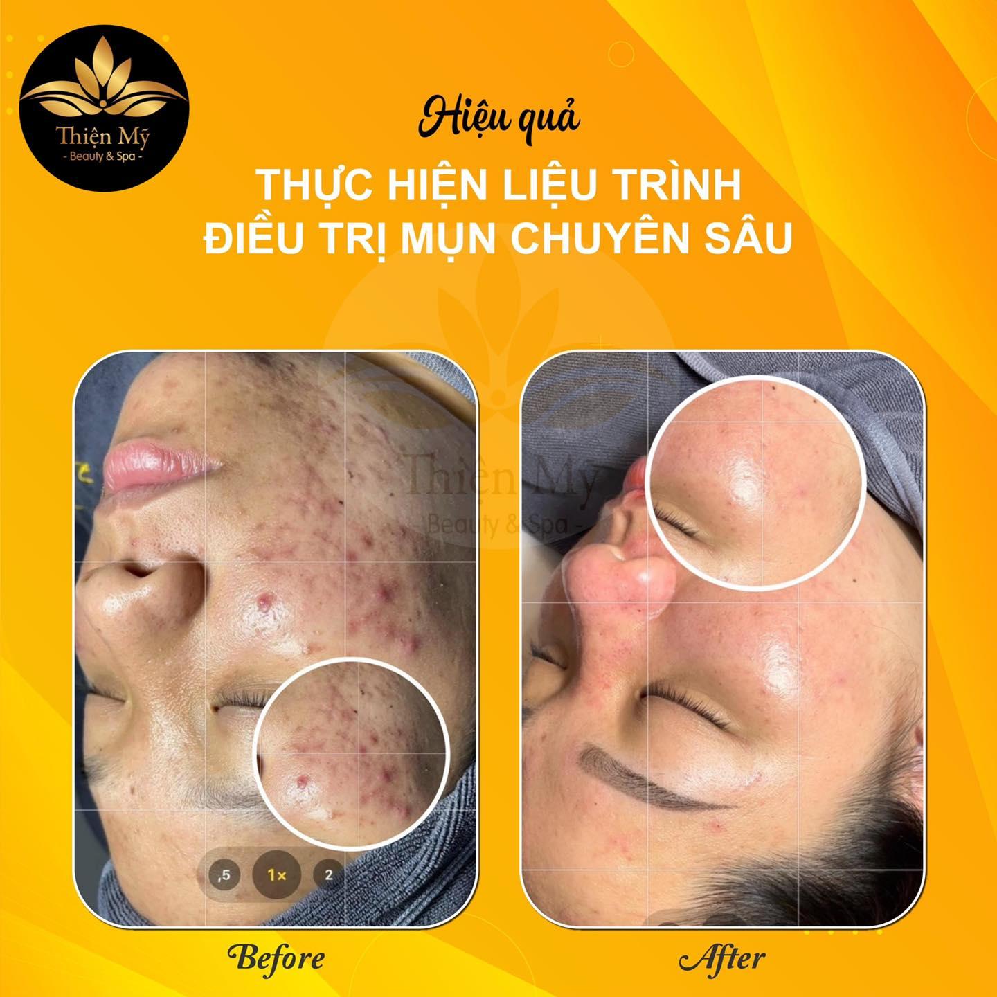 Top 10 Spa làm đẹp uy tín và chất lượng nhất tại Thái Nguyên