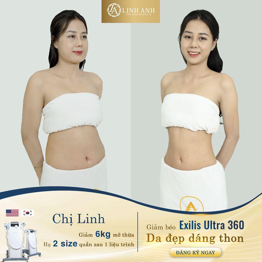 Top 6 Thẩm mỹ viện giảm béo và điêu khắc body uy tín nhất tại Đà Nẵng