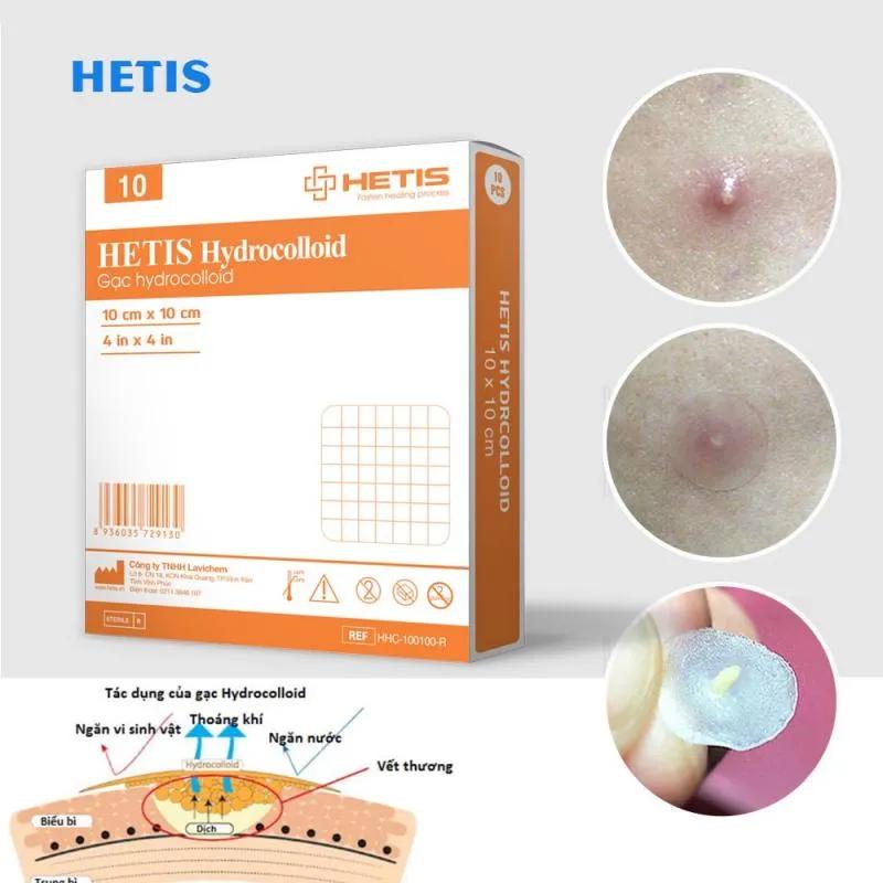 Top 8 Miếng dán mụn Hydrocolloid 'đánh bay' nhân mụn viêm hiệu quả nhất hiện nay