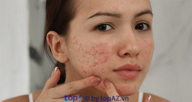 Top 5 địa chỉ Spa trị mụn và làm đẹp chất lượng nhất tại Quận Thanh Khê, Đà Nẵng