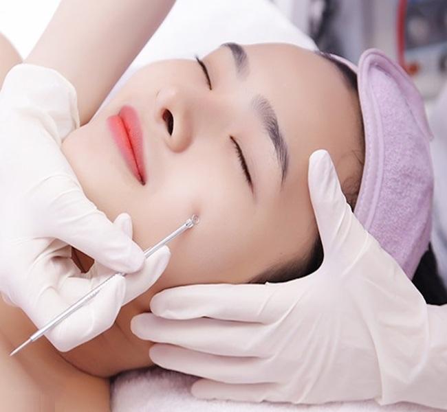 5 địa điểm nặn mụn đạt chuẩn y khoa được đánh giá cao nhất tại cố đô Huế