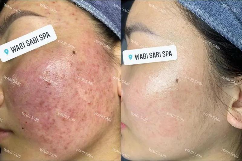 Khám phá 5 spa làm đẹp uy tín tại huyện Đan Phượng, Hà Nội