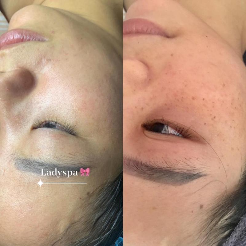 5 Địa chỉ Spa làm đẹp đáng trải nghiệm nhất tại Phú Xuyên, Hà Nội