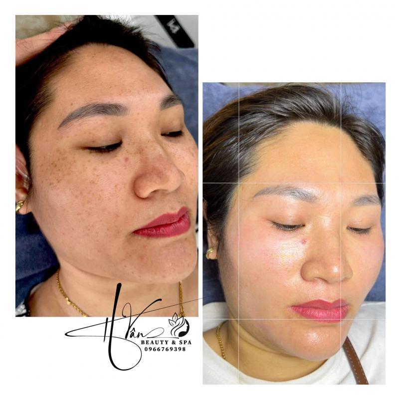Top 5 địa chỉ Spa làm đẹp chất lượng và uy tín bậc nhất huyện Mỹ Đức, Hà Nội
