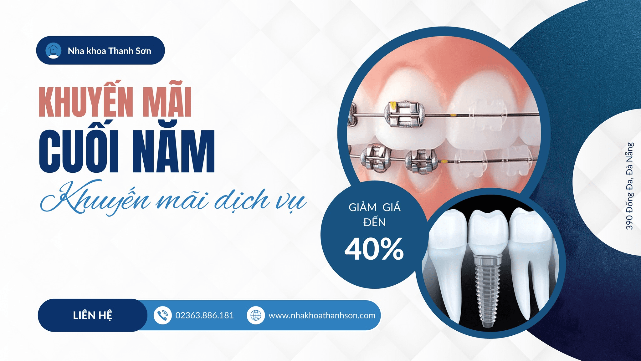 Top 10 địa chỉ cấy ghép răng Implant chất lượng hàng đầu tại Đà Nẵng