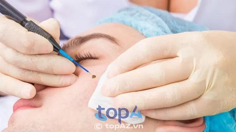 3 Địa Chỉ Tẩy Xóa Nốt Ruồi Tốt Nhất Quận 6 – An Toàn Tuyệt Đối, Hiệu Quả Dứt Điểm