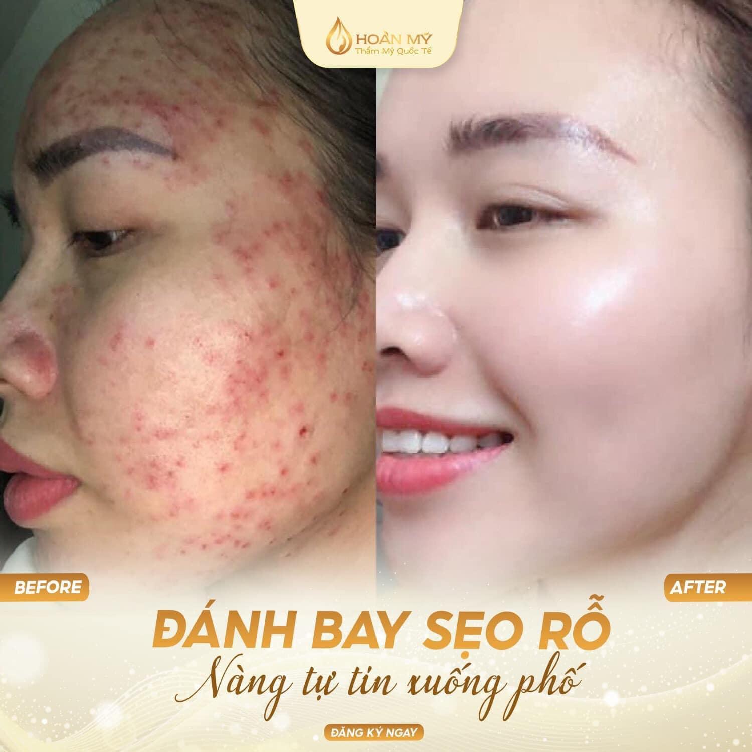 Top 6 Spa Làm Đẹp Uy Tín và Chất Lượng Nhất tại TP. Phan Rang - Tháp Chàm, Ninh Thuận