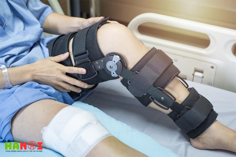 Khoảng thời gian phục hồi để trở lại với thể thao sau phẫu thuật dây chằng chéo là bao lâu?