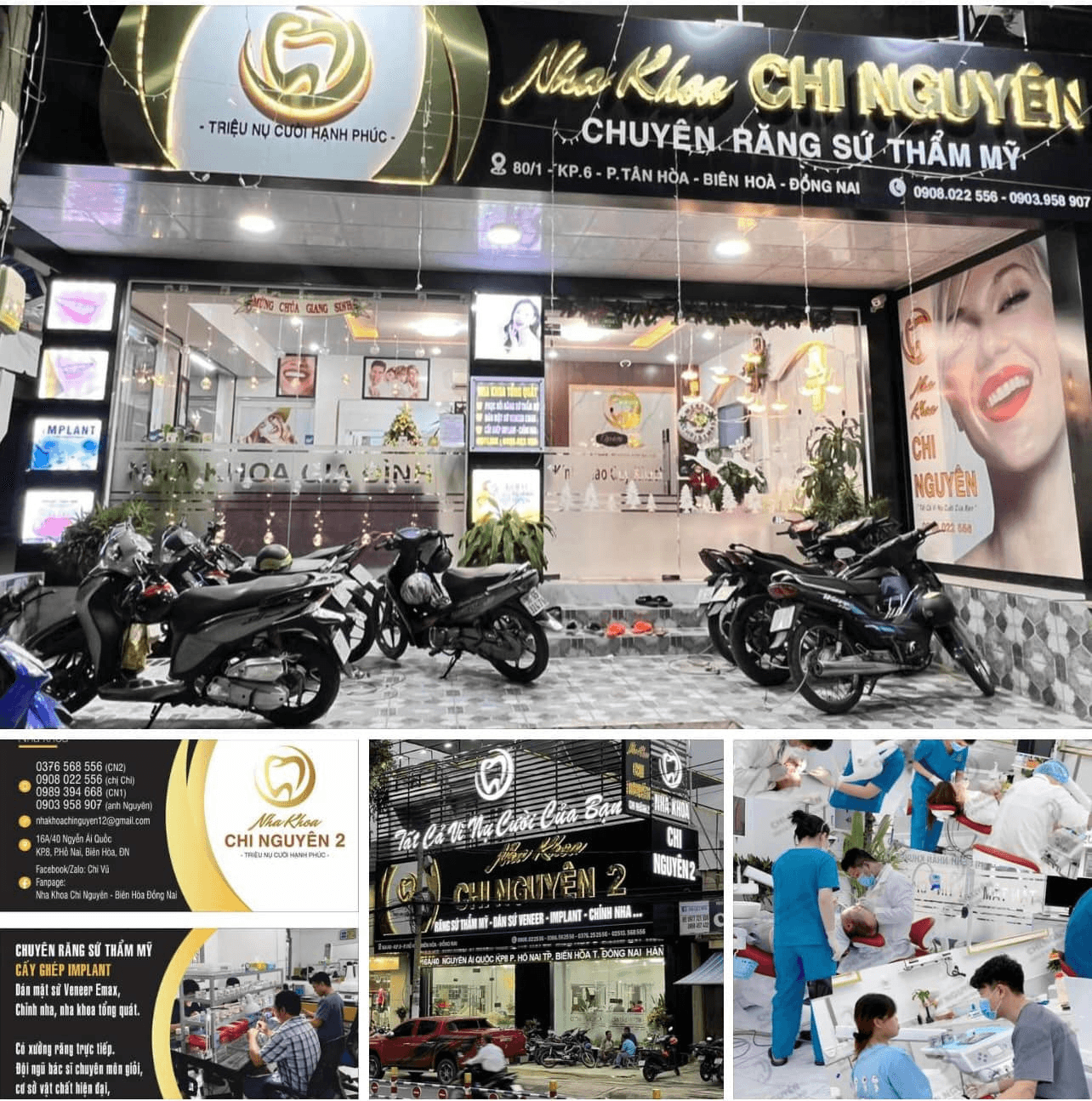 6 Địa chỉ nha khoa dán sứ veneer chất lượng và uy tín hàng đầu tại Đồng Nai