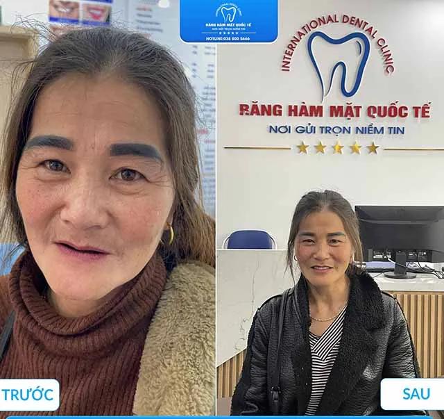 Top 5 phòng khám nha khoa tại TP. Hà Giang với trang thiết bị hiện đại và tiên tiến.