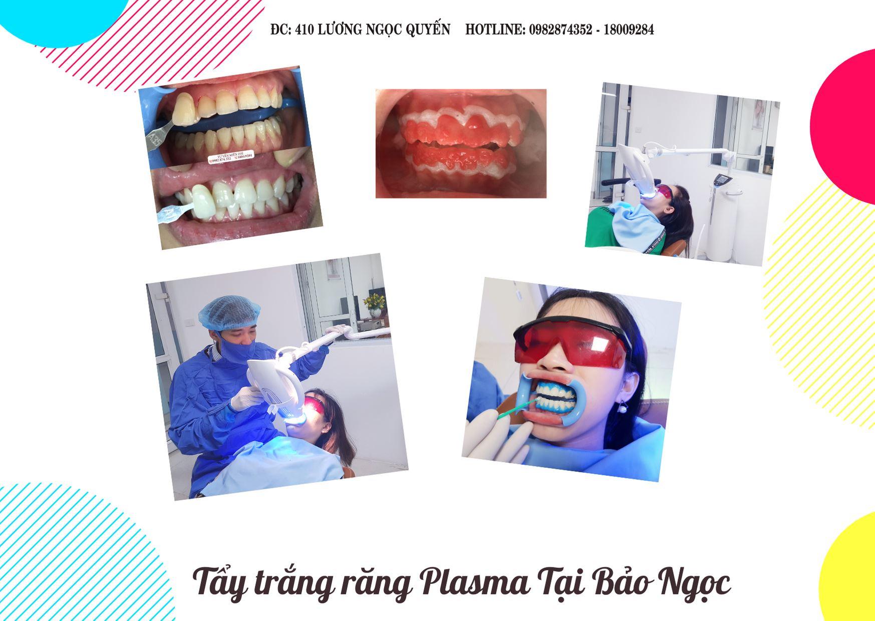 Khám Phá Top 5 Địa Chỉ Tẩy Trắng Răng Uy Tín Nhất Tại Thái Nguyên