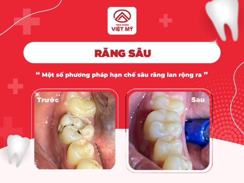 Top 5 địa chỉ nha khoa uy tín và chất lượng nhất tại Trà Vinh