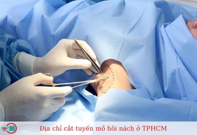Top 7 địa chỉ cắt tuyến mồ hôi nách uy tín và an toàn tại TP.HCM