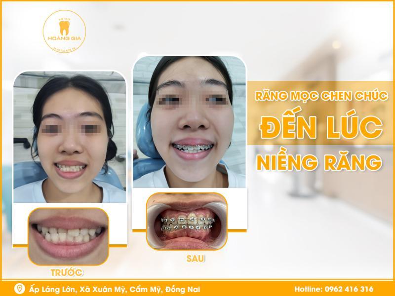 Top 5 phòng khám nha khoa uy tín tại huyện Cẩm Mỹ, Đồng Nai