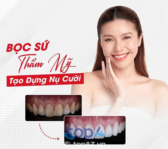 Khám phá 5 địa chỉ bọc răng sứ uy tín và chất lượng tại Nha Trang