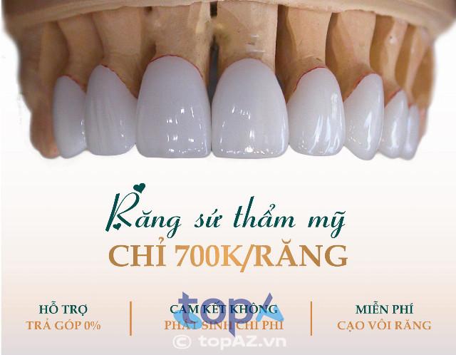 Top 5 địa chỉ bọc răng sứ Đà Lạt đẹp tự nhiên, chuẩn nha khoa thẩm mỹ