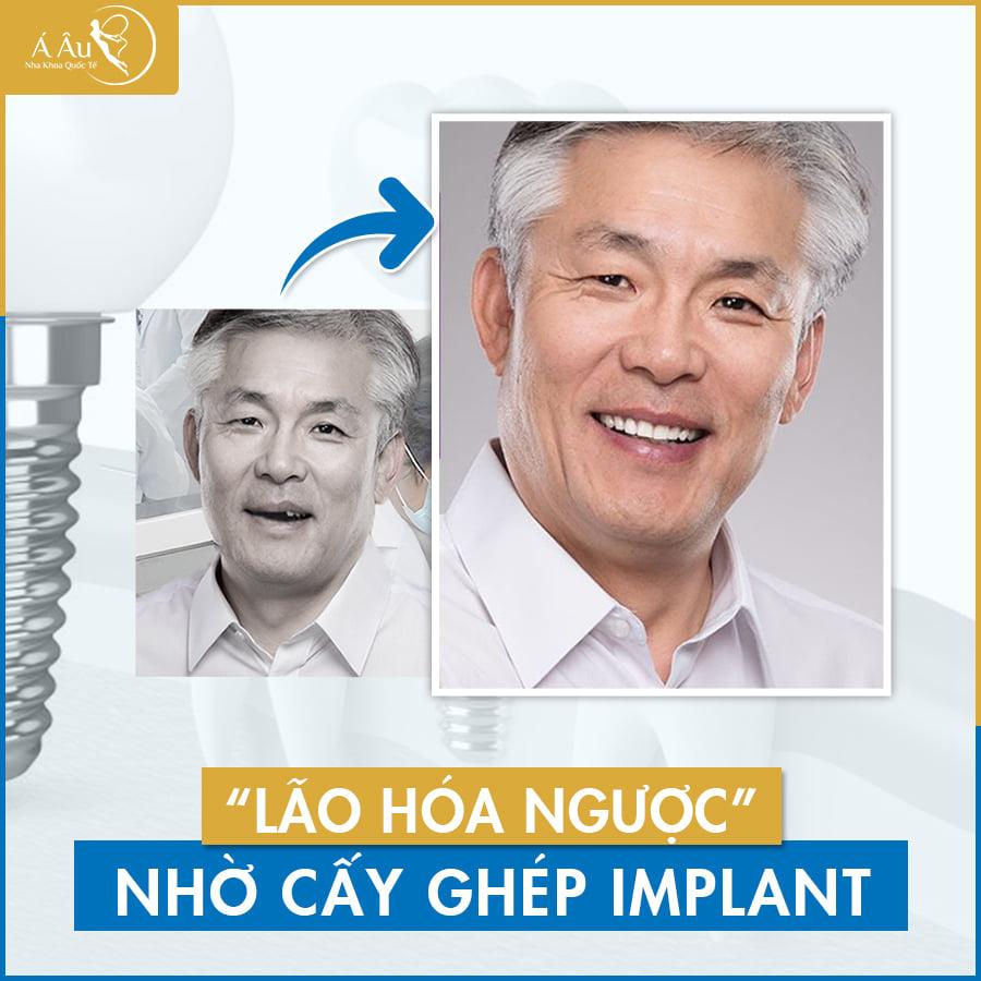 8 Địa chỉ phòng khám nha khoa chất lượng nhất quận 1, TP HCM