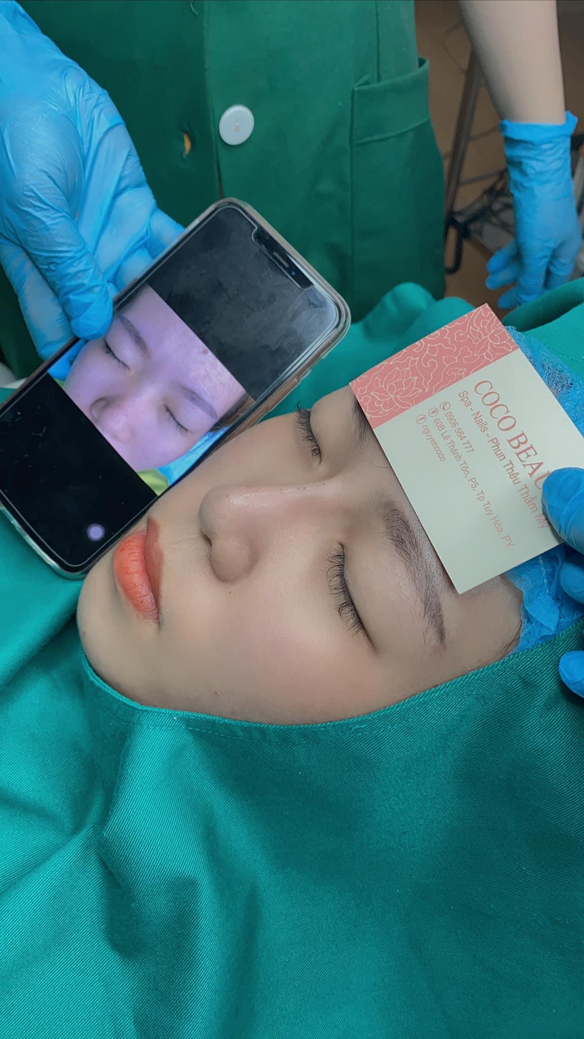 Top 4 Địa Chỉ Tiêm Filler - Botox Uy Tín Và Chất Lượng Nhất Tại Phú Yên