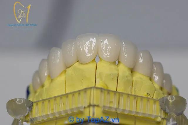 Top 5 địa chỉ làm răng dán sứ Veneer đẹp và uy tín tại Đà Nẵng