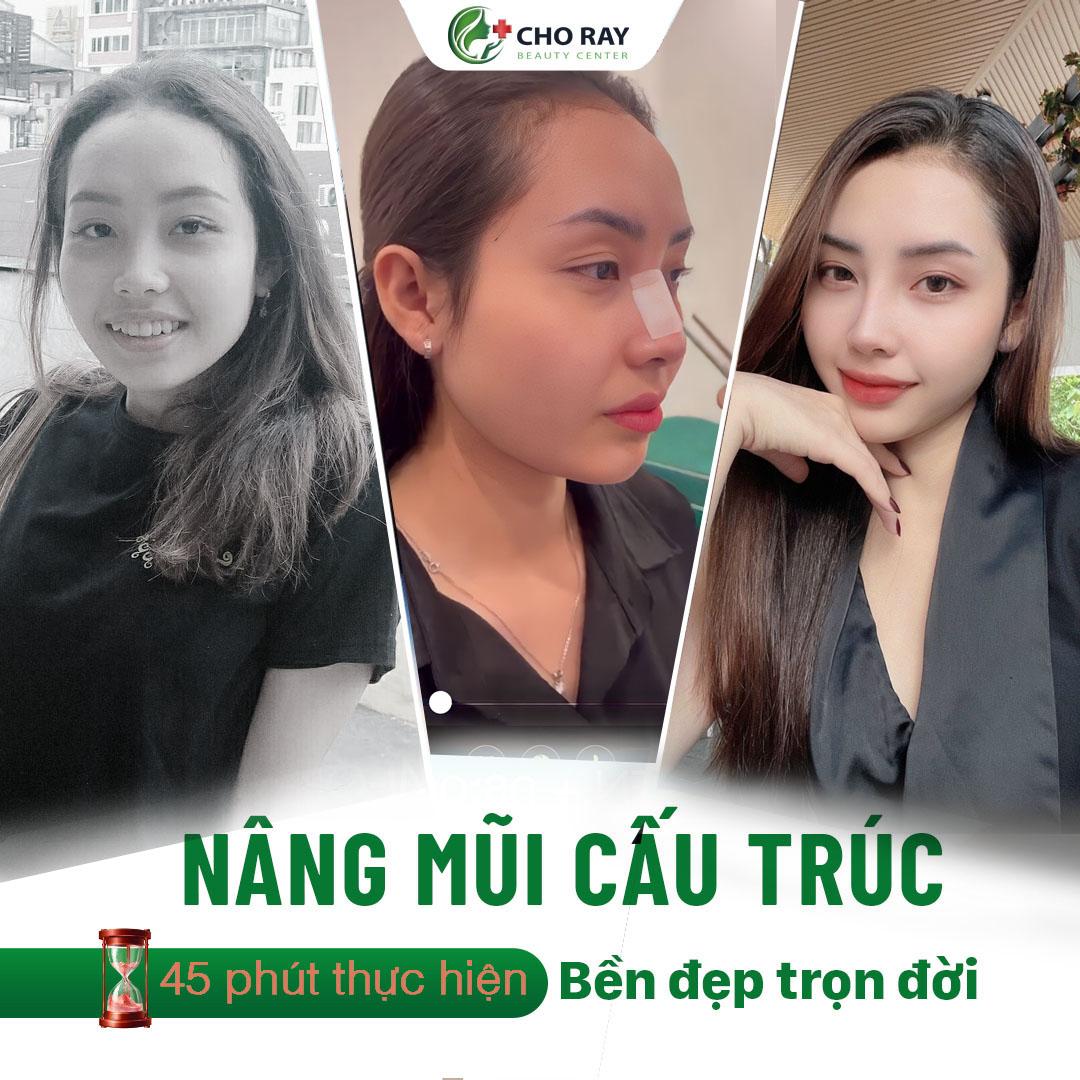 8 Địa chỉ thẩm mỹ viện đáng trải nghiệm nhất tại Nha Trang
