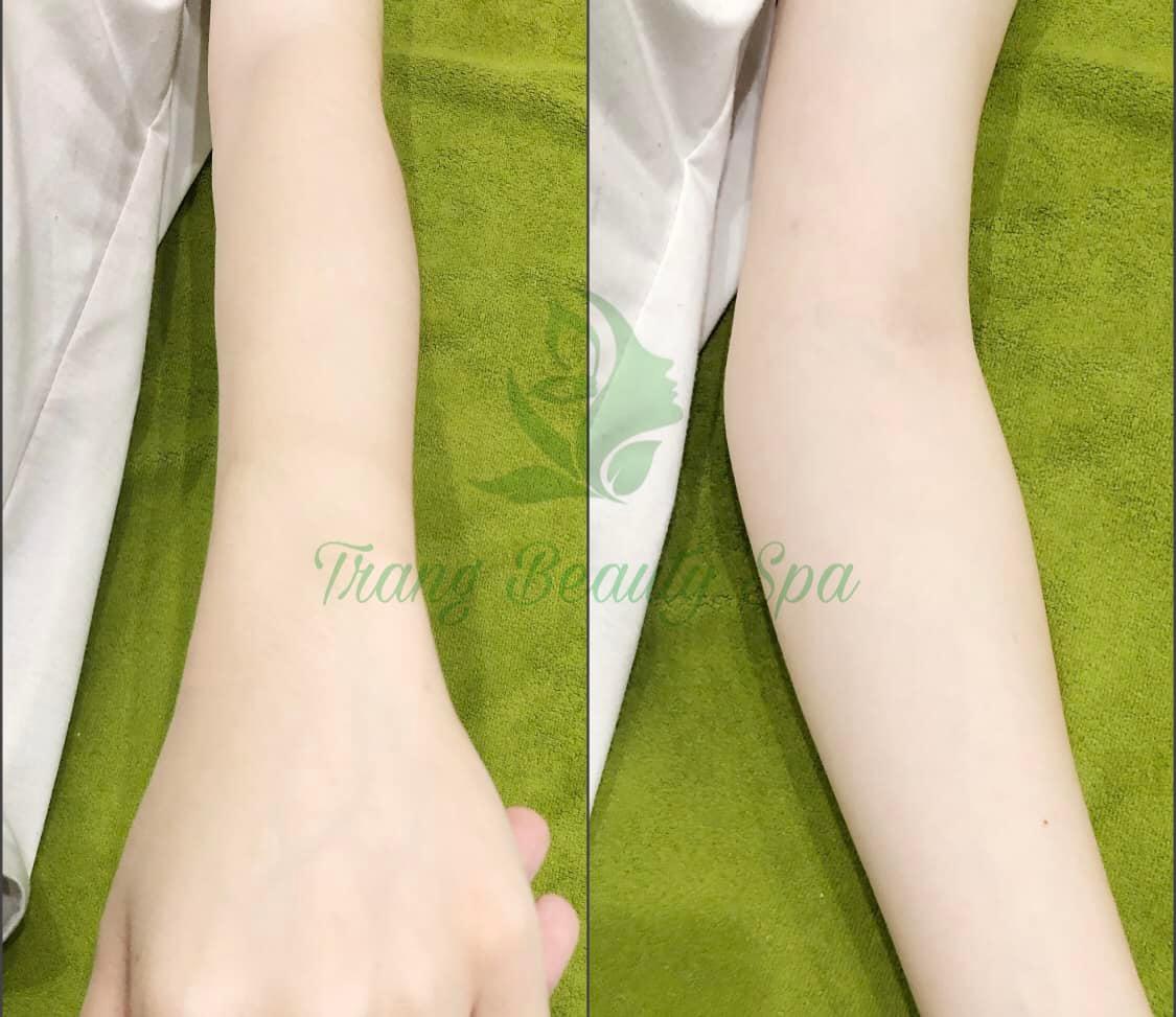 Top 3 thẩm mỹ viện và spa uy tín nhất huyện Càng Long, Trà Vinh