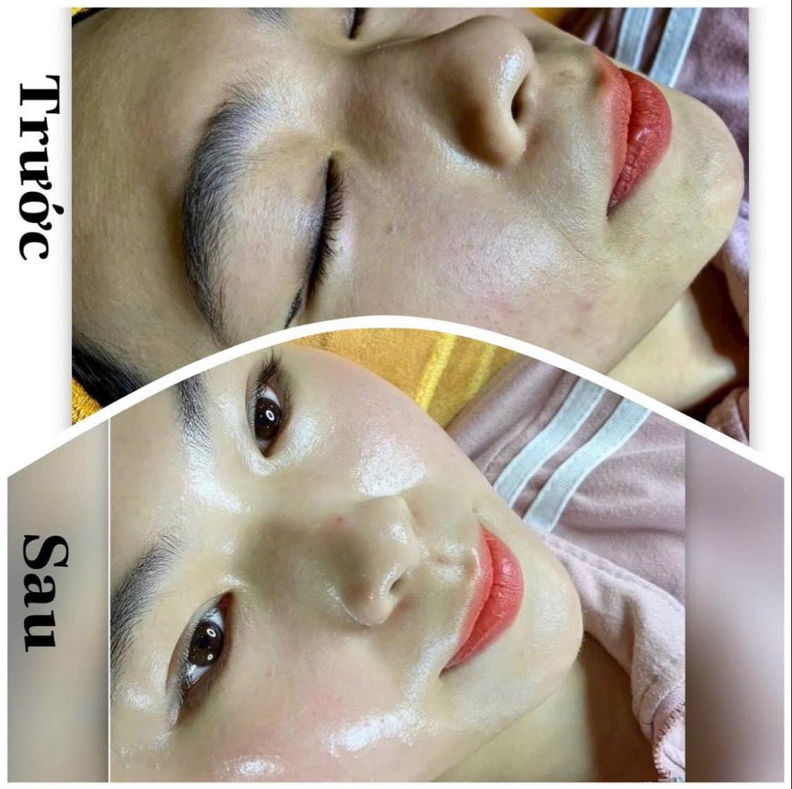 Top 4 địa chỉ thẩm mỹ viện & spa chất lượng nhất Mỏ Cày Nam, Bến Tre