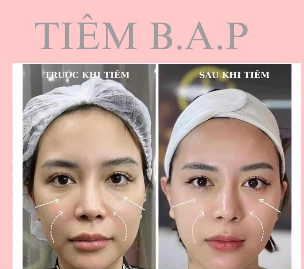 Top 12 địa chỉ spa làm đẹp chất lượng và đáng tin cậy nhất tại Hải Dương