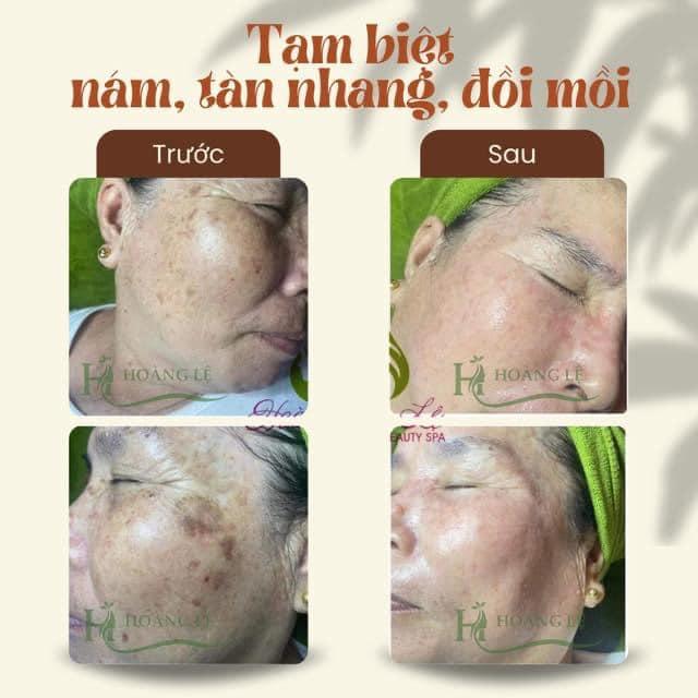 6 Địa Chỉ Spa Làm Đẹp Đáng Tin Cậy Nhất Tại Thành Phố Đồng Hới, Quảng Bình